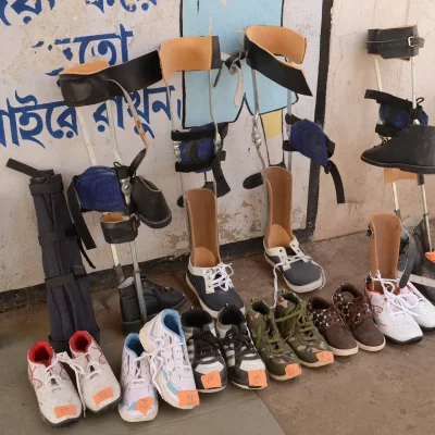 limbs-distributions-photo-1